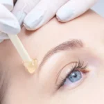 Hair Removal with Nufree Wax