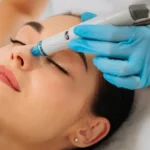 hydra facial