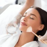 chemical peel