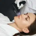 RF Microneedling