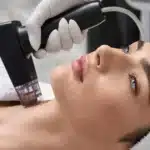 RF-Microneedling