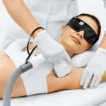 Why It’s the Best Choice for Permanent Hair Reductions