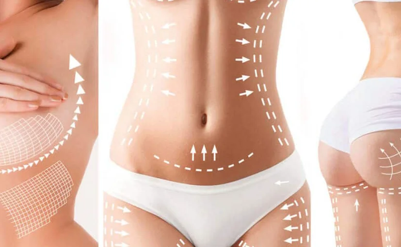 Jade-BodySculpt-Results